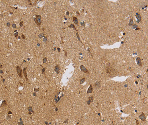ITPR3 Polyclonal Antibody – Figure 1 of 3