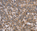EPOR Polyclonal Antibody – Figure 1 of 4