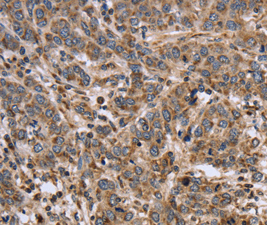 EPOR Polyclonal Antibody – Figure 1 of 4