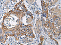 RITA1 Polyclonal Antibody – Figure 1 of 2