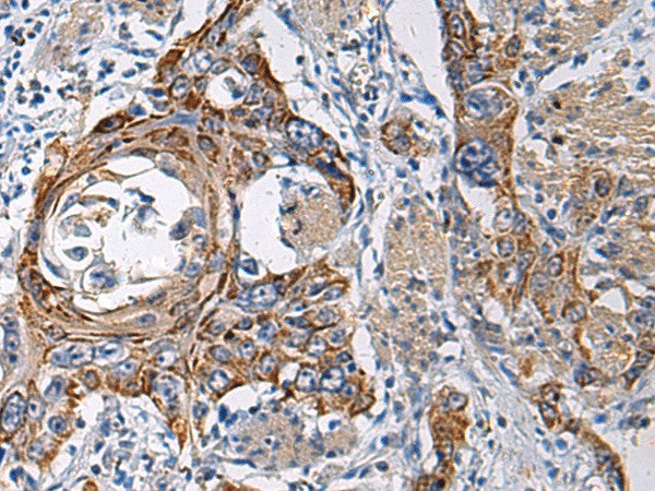 RITA1 Polyclonal Antibody – Figure 1 of 2