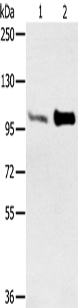ACTN2 Polyclonal Antibody – Figure 1 of 4