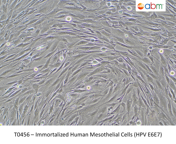 Immortalized Human Mesothelial Cells (HPV E6E7) – Figure 1 of 1