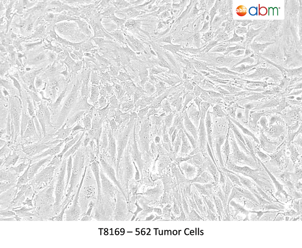 562 Tumor Cells – Figure 1 of 1