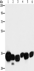 CBR1 Polyclonal Antibody – Figure 1 of 4