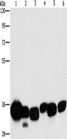 CBR1 Polyclonal Antibody – Figure 1 of 4