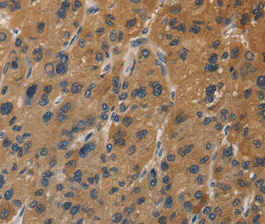 DUSP23 Polyclonal Antibody – Figure 1 of 3
