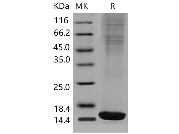 Recombinant Mouse FABP4/A-FABP Protein (HEK293, His Tag) – Figure 1 of 2