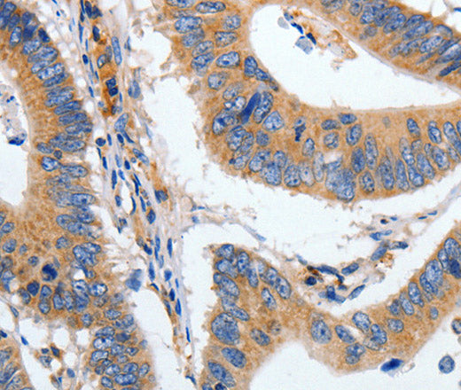 HSPA1A Polyclonal Antibody – Figure 1 of 2