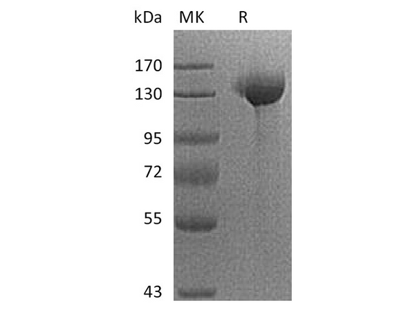 Recombinant Human SIGLEC2/CD22 Protein (Fc Tag) – Figure 1 of 2