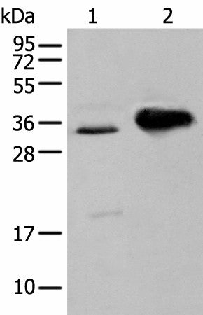 ATP6V1E2 Polyclonal Antibody – Figure 1 of 2