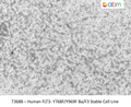 Human FLT3- Y768F/Y969F Ba/F3 Stable Cell Line | Applied Biological Materials (abm)