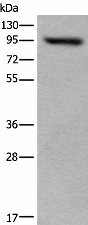 USP6NL Polyclonal Antibody – Figure 1 of 3