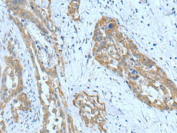 SRPK2 Polyclonal Antibody – Figure 1 of 2