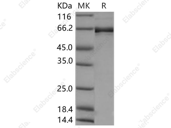 Recombinant Human EphB2 Protein (aa 570-987, His &GST Tag) - Figure 1 of 2