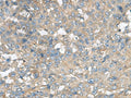 CXCR5 Polyclonal Antibody – Figure 1 of 3