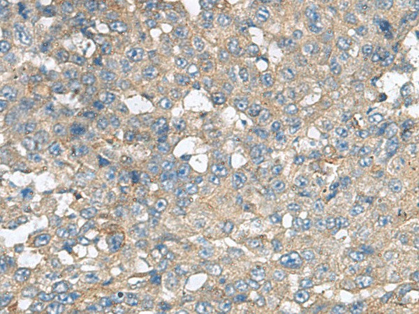 CXCR5 Polyclonal Antibody – Figure 1 of 3