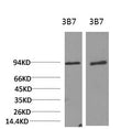 PI 3 kinase p85 alpha Monoclonal Antibody – Figure 1 of 4