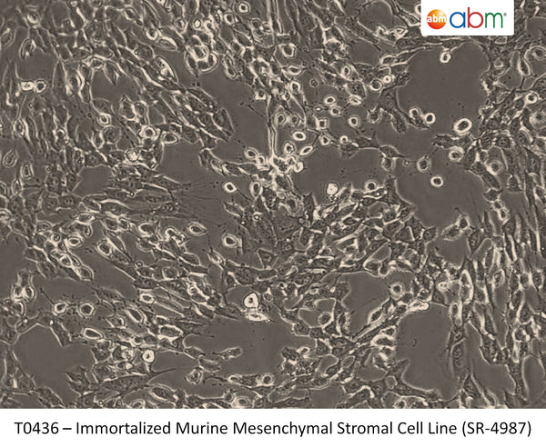 Immortalized Murine Mesenchymal Stromal Cell Line (SR-4987) | Applied Biological Materials (abm)
