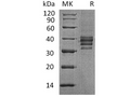 Recombinant Human Follistatin 288/FST Protein – Figure 1 of 2