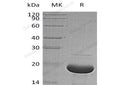 Recombinant Human Alpha-Synuclein/SNCA Protein (His Tag) – Figure 1 of 2