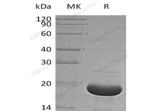 Recombinant Human Alpha-Synuclein/SNCA Protein (His Tag) – Figure 1 of 2