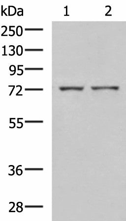 ZAP70 Polyclonal Antibody – Figure 1 of 3