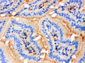 Anti-Actin antibody, MA1000, IHC(F)
IHC(F): Mouse Intestine Tissue