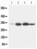 Anti-Bcl-2 Antibody (Monoclonal, Bcl-2-100)