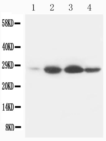 Anti-Bcl-2 Antibody (Monoclonal, Bcl-2-100)