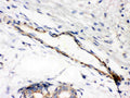 Anti-Caldesmon(smooth) antibody, MA1009, IHC(P)
IHC(P): Human Mammary Cancer Tissue