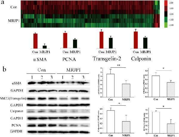 Anti-Calponin Cnn2 Antibody (Monoclonal, CP-93)