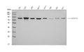 Anti-Catenin Gamma (Plakoglobin) Jup Antibody (Monoclonal, 15F11)