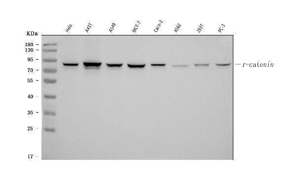 Anti-Catenin Gamma (Plakoglobin) Jup Antibody (Monoclonal, 15F11)
