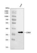 Anti-CDK6 Antibody (Monoclonal, DCS-90)