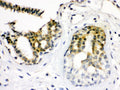 Anti-Cdk7/CAK antibody (monoclonal), MA1022, IHC(P)
 IHC(P): Human Breast Tissue