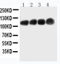 Anti-CEACAM5/Cd66e Monoclonal Antibody