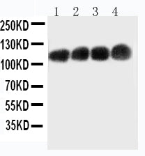 Anti-CEACAM5/Cd66e Monoclonal Antibody