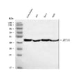Anti-Cytokeratin Peptide 18 KRT18 Antibody (Monoclonal, CY-90)