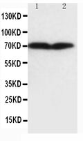 Anti-Collagen, Type III antibody (monoclonal), MA1029, Western blotting
Lane 1: HT1080 Cell Lysate
Lane 2: COLO320 Cell Lysate