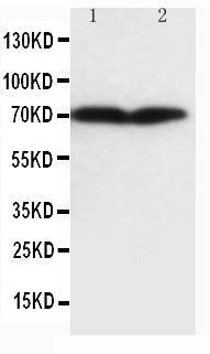Anti-Collagen, Type III antibody (monoclonal), MA1029, Western blotting
Lane 1: HT1080 Cell Lysate
Lane 2: COLO320 Cell Lysate