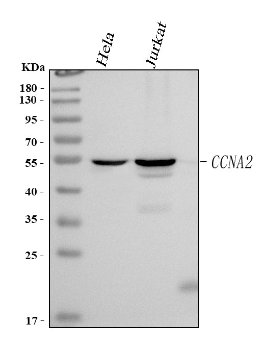 Anti-Cyclin A Ccna2 Antibody (Monoclonal, CY-A1)