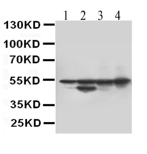 Anti-Desmin Antibody (Monoclonal, DE-U-10)
