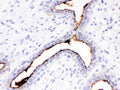 Anti-Episialin, EMA antibody, MA1039, IHC(P)
IHC(P): Human Mammary Cancer Tissue