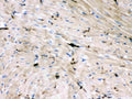 Anti-GAP43 antibody, MA1042, IHC(P)
IHC(P): Rat Cardiac Muscle Tissue