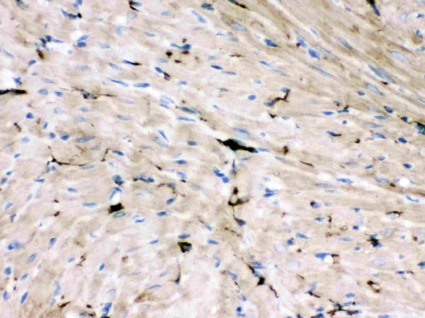 Anti-GAP43 antibody, MA1042, IHC(P)
IHC(P): Rat Cardiac Muscle Tissue