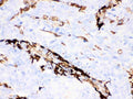 Anti-Gelsolin Gsn Antibody (Monoclonal, GS-2C4)