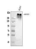 Anti-P-GlycoProtein(MDR) ABCB1 Antibody (Monoclonal, F4)