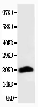 Anti-Myosin(Skeletal, Fast) MYH2 Antibody (Monoclonal, MY-32)