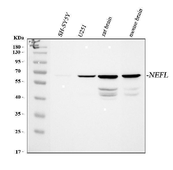 Anti-NF68 Nefl Antibody (Monoclonal, NR4)